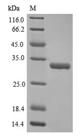 (Tris-Glycine gel) Discontinuous SDS-PAGE (reduced) with 5% enrichment gel and 15% separation gel.
