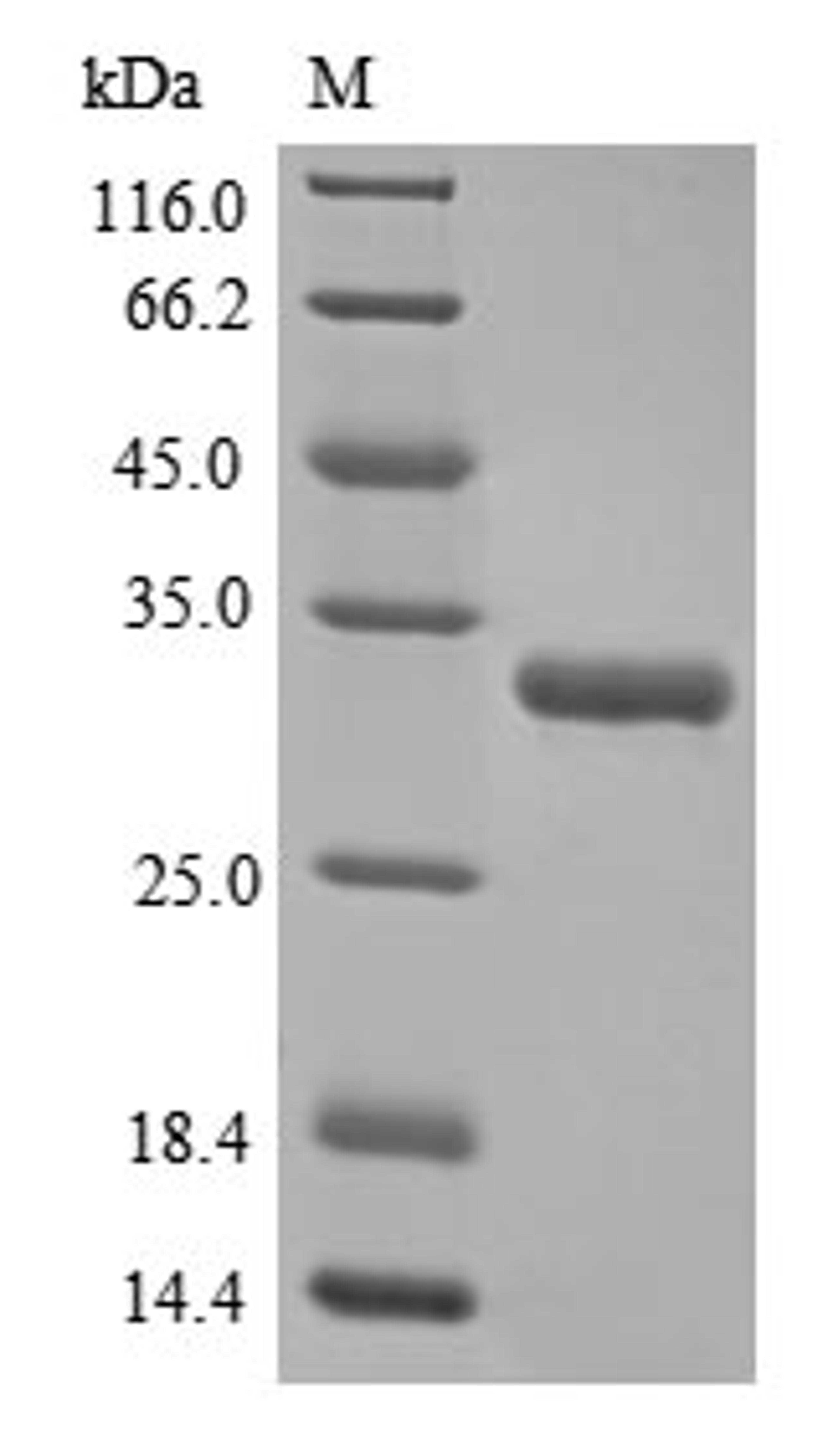(Tris-Glycine gel) Discontinuous SDS-PAGE (reduced) with 5% enrichment gel and 15% separation gel.