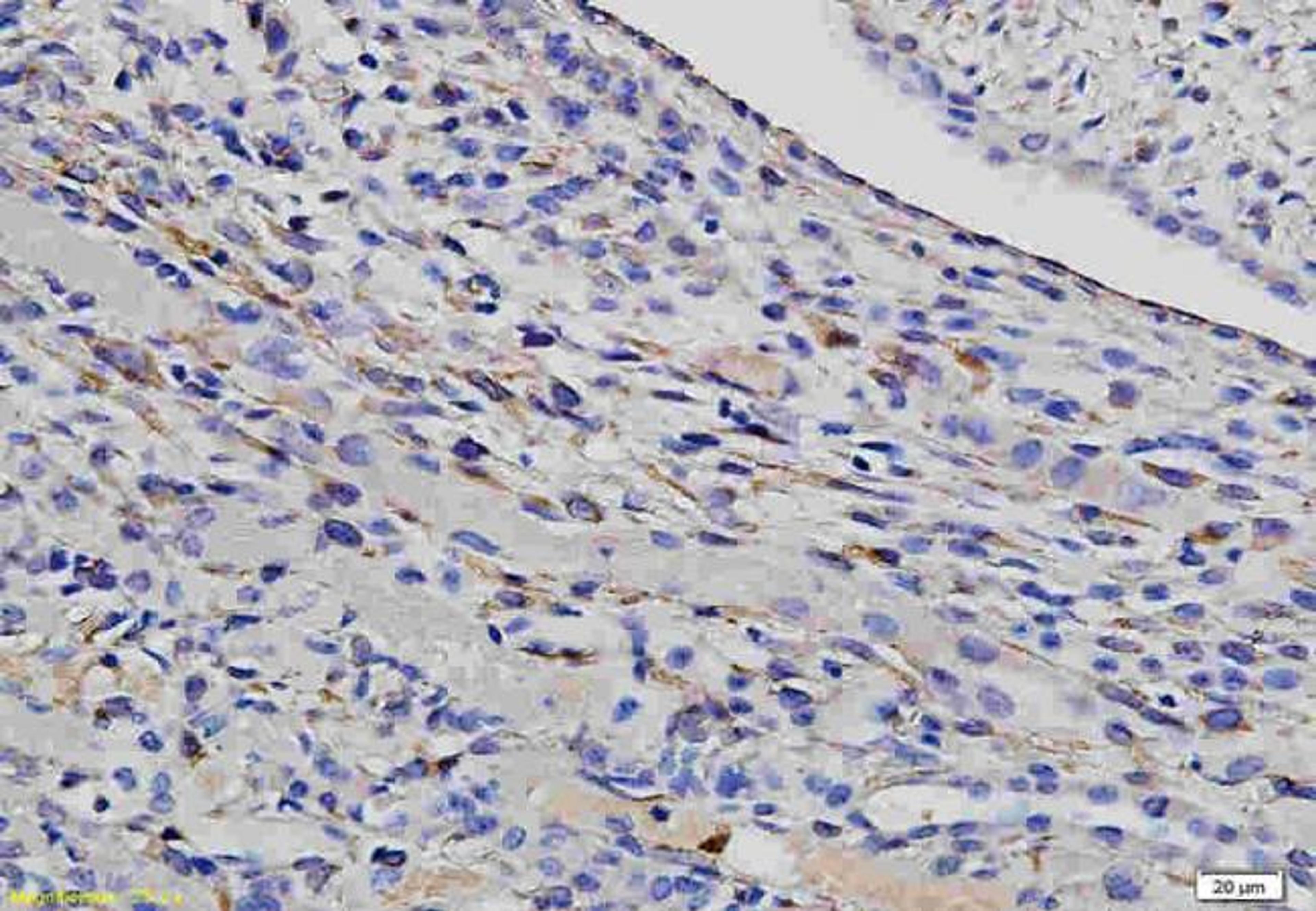 IHC-P of mouse kidney tissue using Fibrillin 1 antibody.