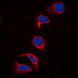 Immunofluorescense analysis of HeLa cells using c-CBL (phospho-Y700) antibody