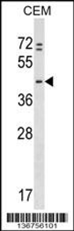 Western blot analysis in CEM cell line lysates (35ug/lane).