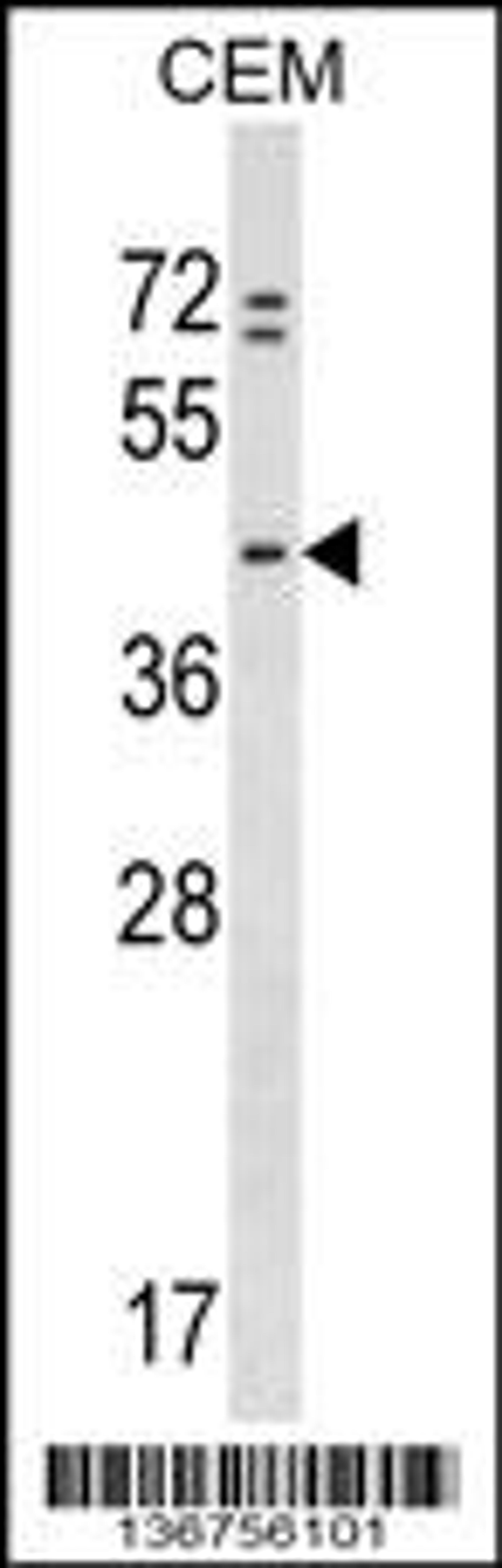 Western blot analysis in CEM cell line lysates (35ug/lane).