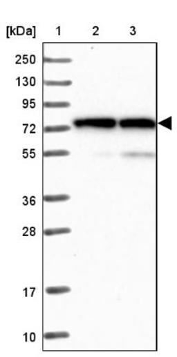 Western Blot: Lysyl tRNA synthetase Antibody [NBP1-87705] - Lane 1: Marker [kDa] 250, 130, 95, 72, 55, 36, 28, 17, 10<br/>Lane 2: Human cell line RT-4<br/>Lane 3: Human cell line U-251MG sp