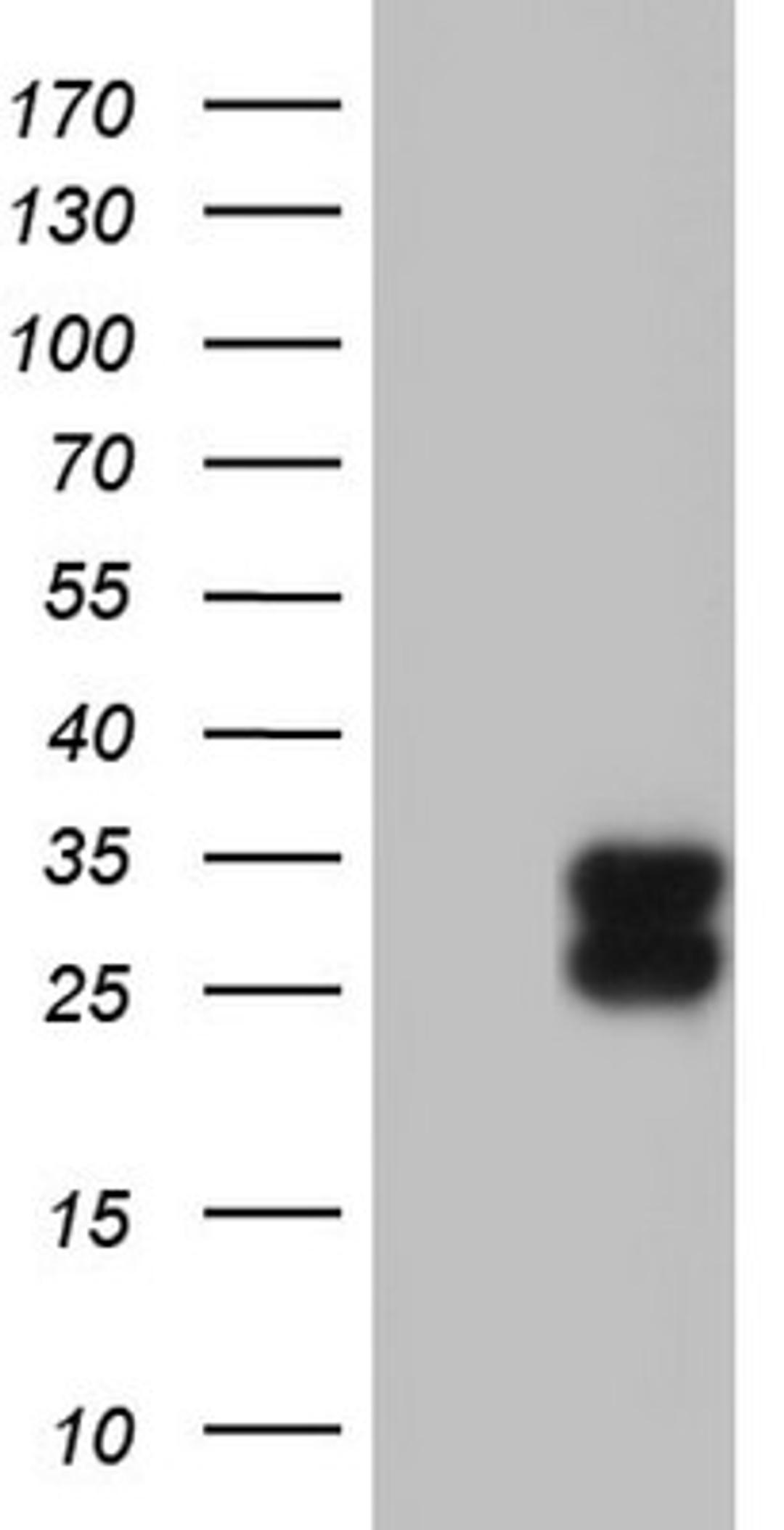 Western Blot: TFPI-2 Antibody (1D4) [NBP2-46100] - Analysis of HEK293T cells were transfected with the pCMV6-ENTRY control (Left lane) or pCMV6-ENTRY TFPI-2.