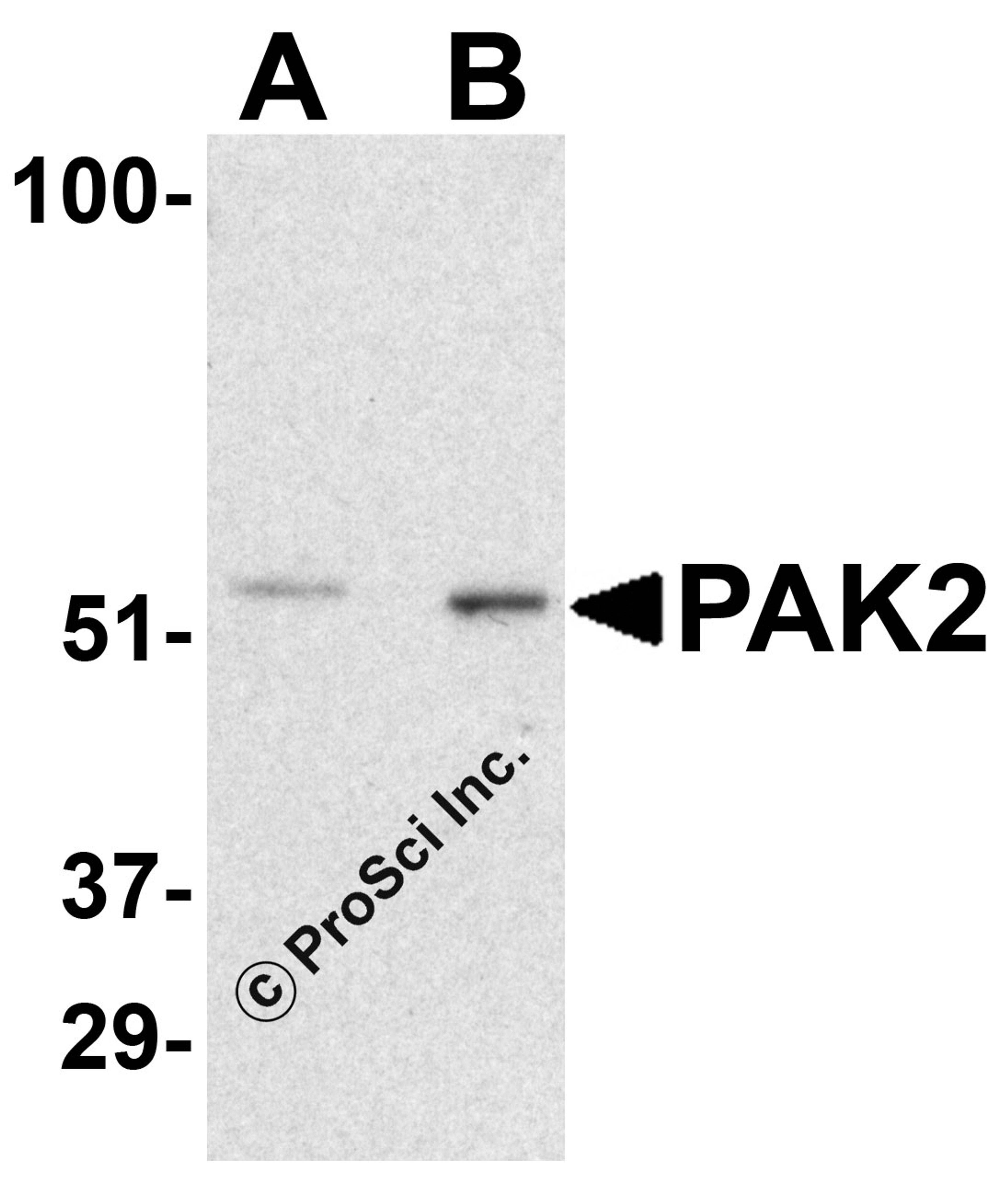 Western blot analysis of PAK2 in rat bladder tissue lysate with PAK2 antibody at (A) 0.5 and (B) 1 &#956;g/mL.