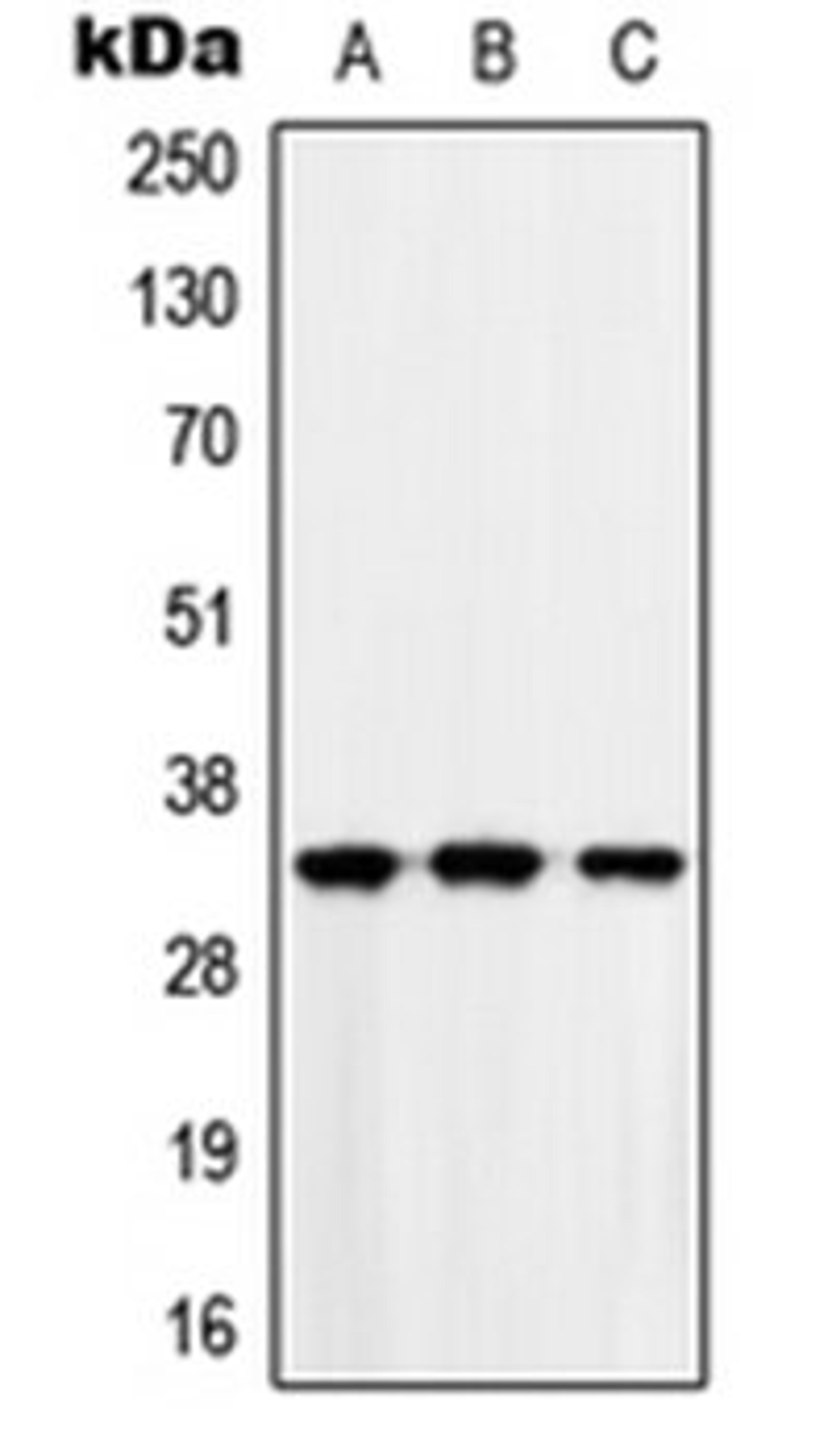 Western blot analysis of HEK293T (Lane 1), Raw264.7 (Lane 2), H9C2 (Lane 3) whole cell lysates using MAD2L1BP antibody