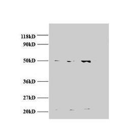 Western blot. All lanes: AP2M1 antibody at 2µg/ml. Lane 1: Jurket whole cell lysate. Lane 2: U87 whole cell lysate. Lane 3: U251 whole cell lysate. Secondary. Goat polyclonal to rabbit IgG at 1/15000 dilution. Predicted band size: 50 kDa. Observed band size: 50, 22 kDa