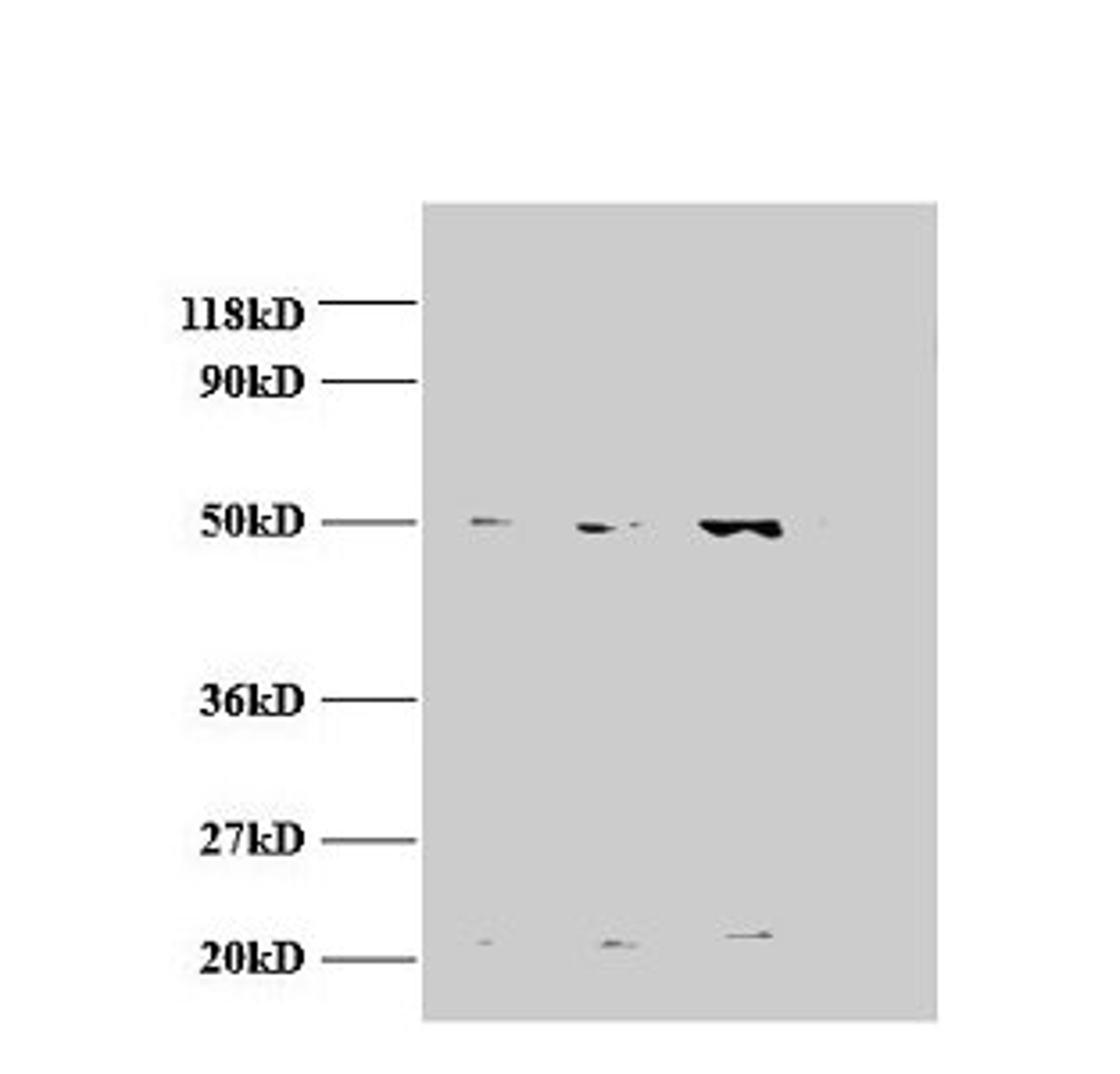 Western blot. All lanes: AP2M1 antibody at 2µg/ml. Lane 1: Jurket whole cell lysate. Lane 2: U87 whole cell lysate. Lane 3: U251 whole cell lysate. Secondary. Goat polyclonal to rabbit IgG at 1/15000 dilution. Predicted band size: 50 kDa. Observed band size: 50, 22 kDa