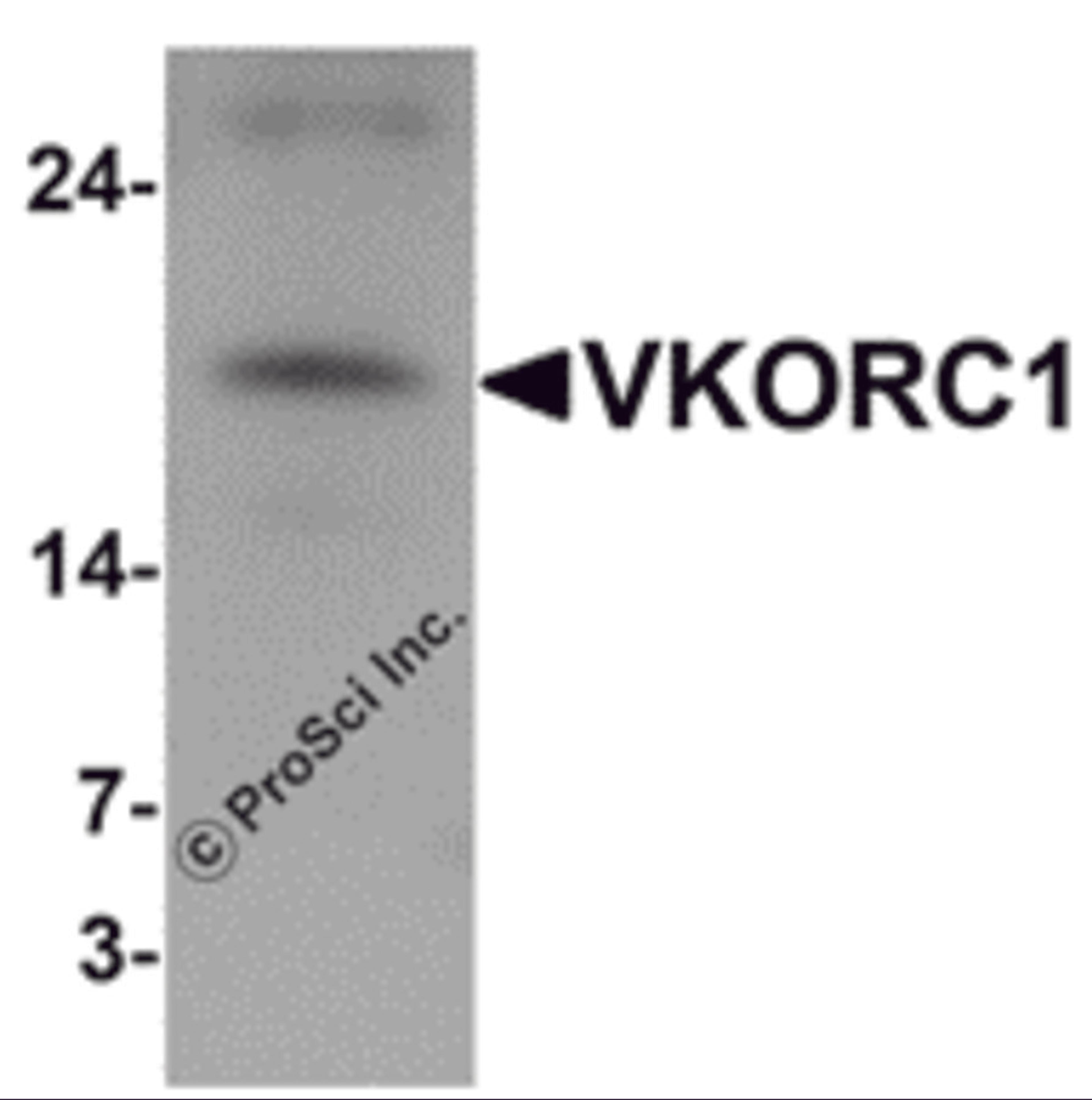 Western blot analysis of VKORC1 in A549 cell lysate with VKORC1 antibody at 1 &#956;g/mL.