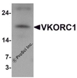 Western blot analysis of VKORC1 in A549 cell lysate with VKORC1 antibody at 1 μg/mL.