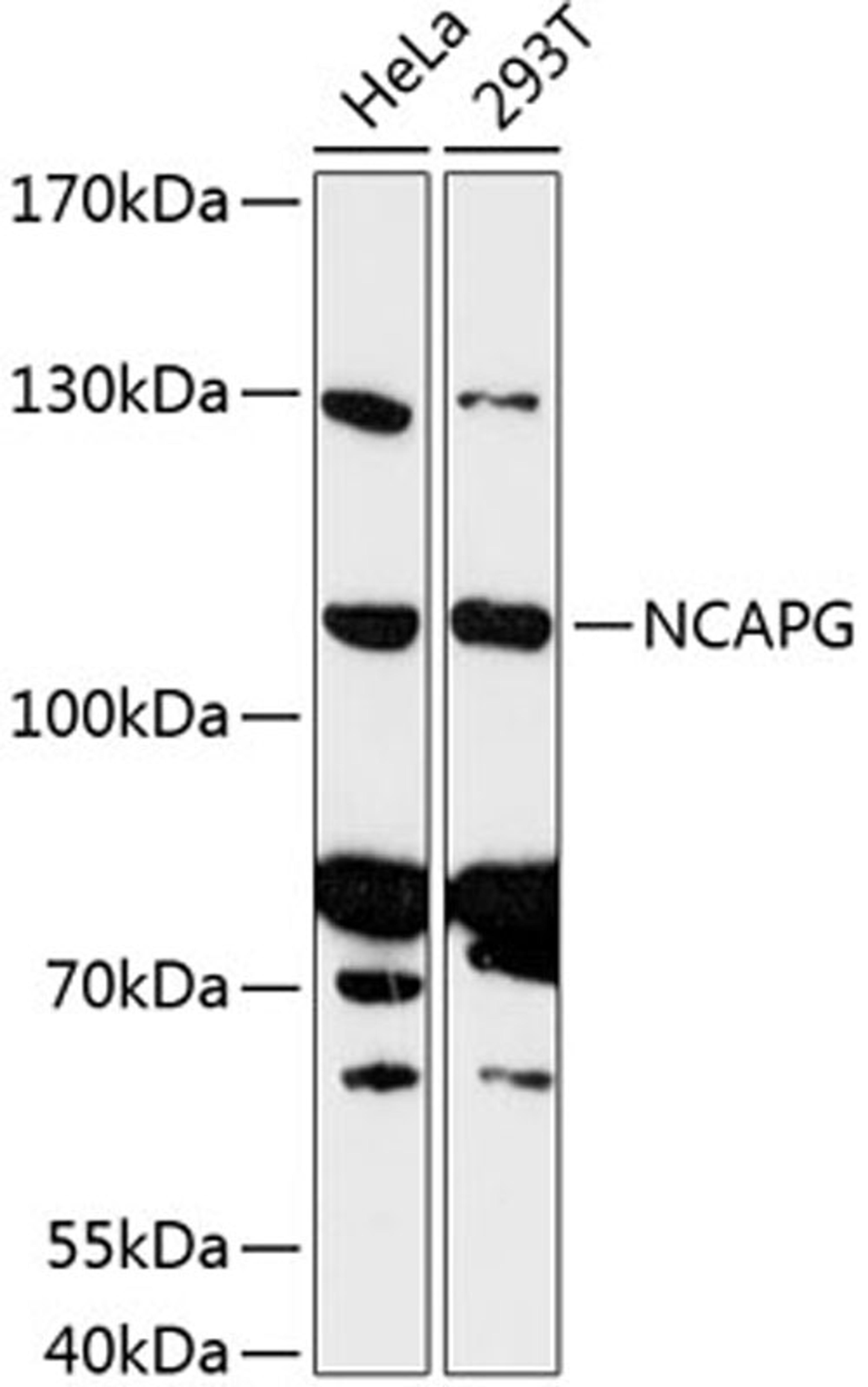 Western blot - NCAPG antibody (A13123)