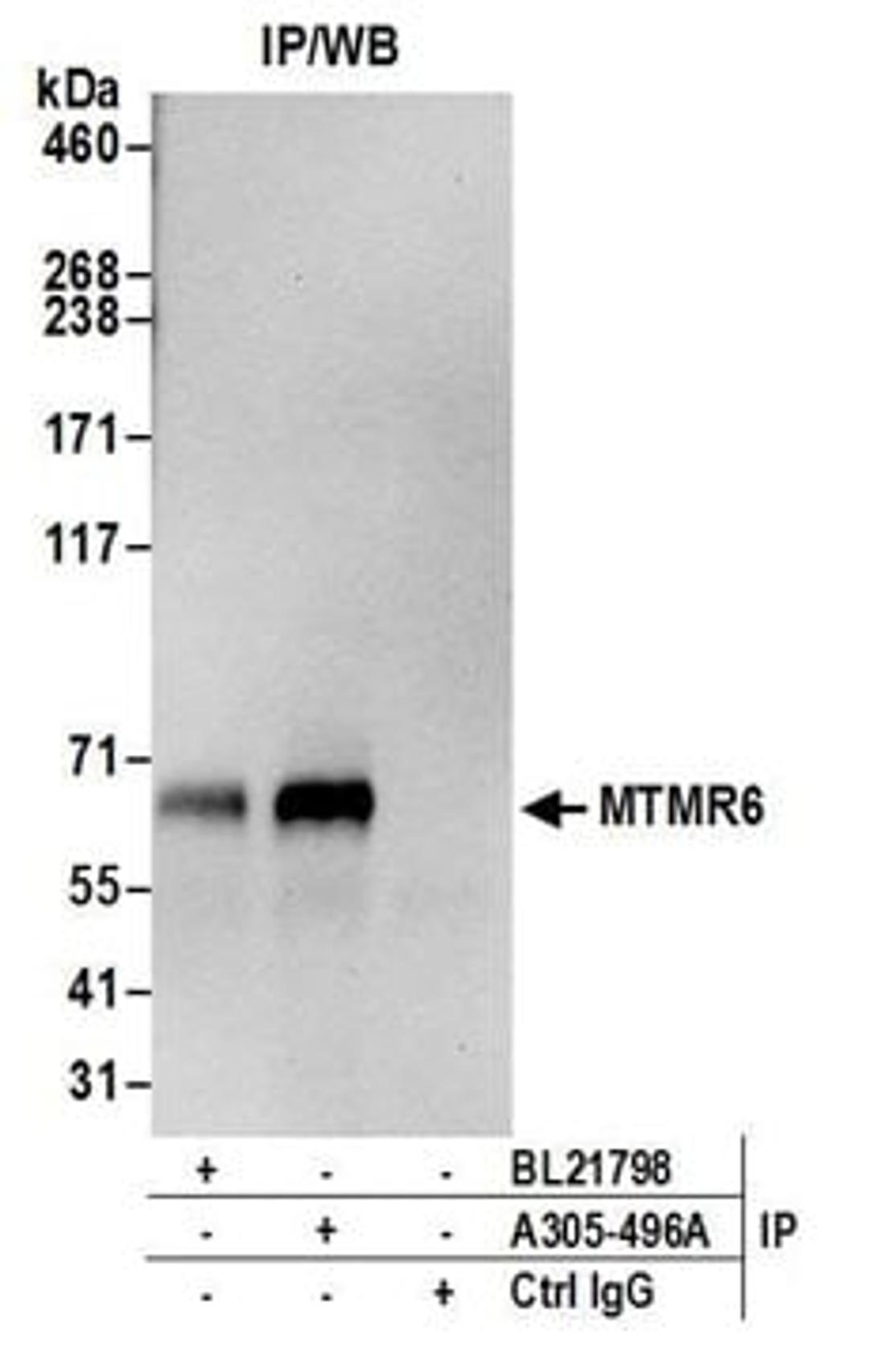 Detection of human MTMR6 by western blot of immunoprecipitates.