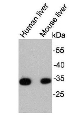 Western blot analysis of tissue lysates using HADHSC antibody