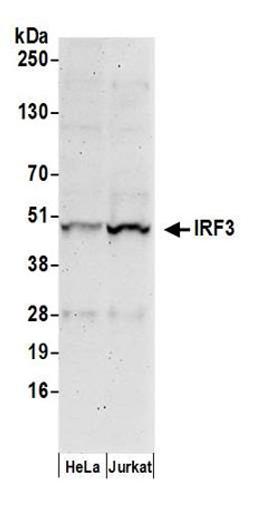 Detection of human IRF3 by western blot.