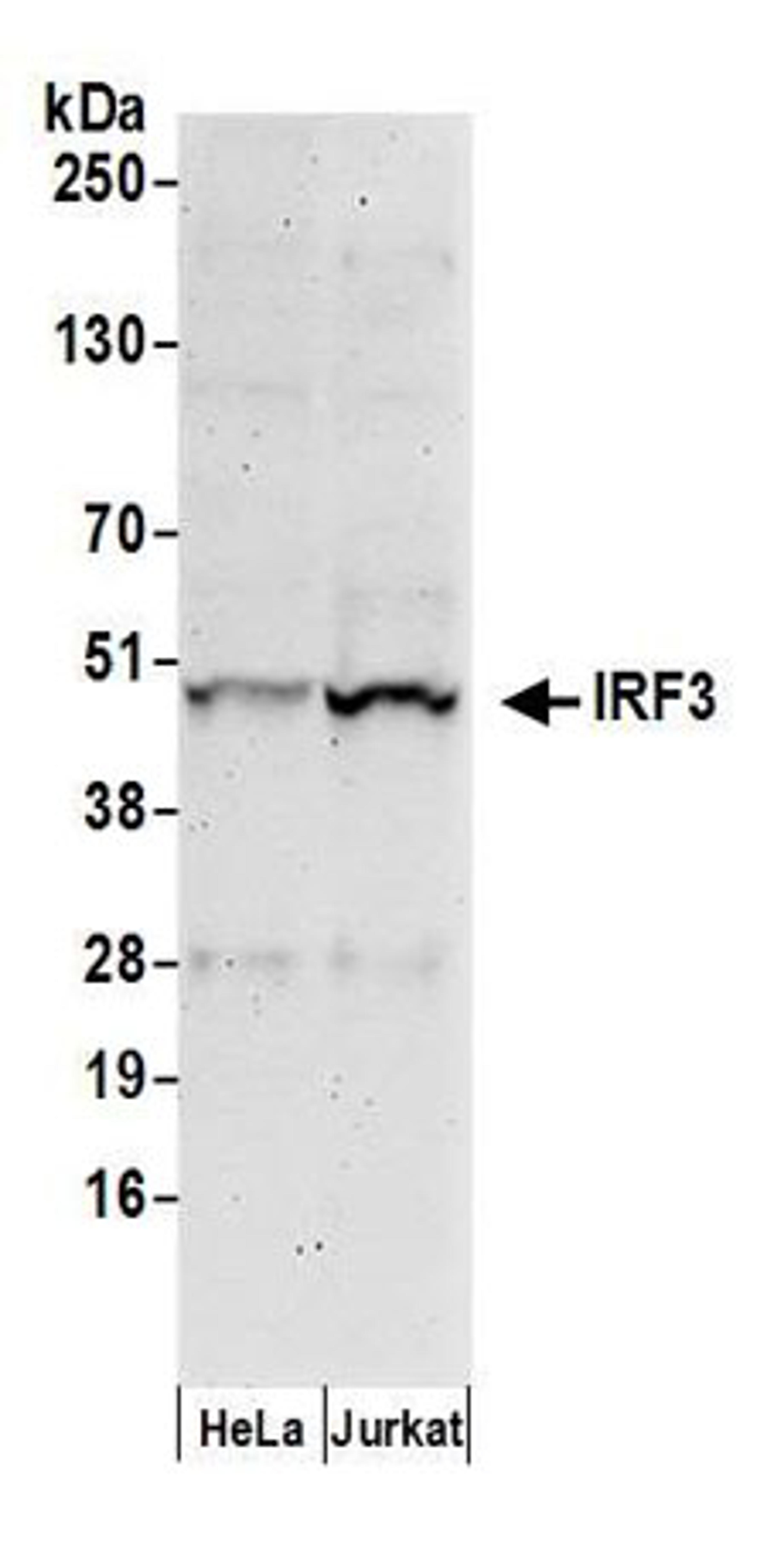 Detection of human IRF3 by western blot.