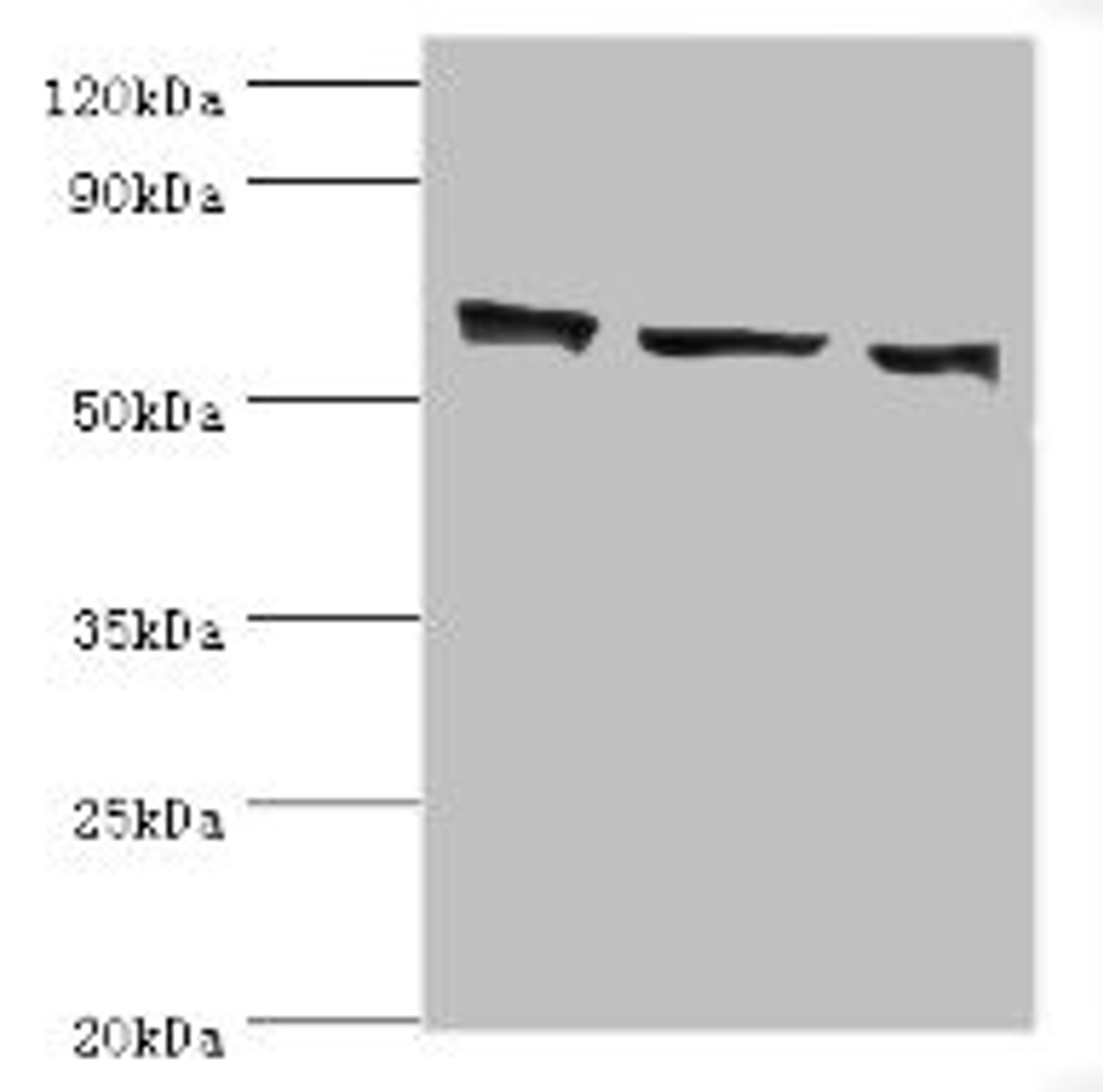 Western blot. All lanes: COIL antibody at 3ug/ml. Lane 1: MCF-7 whole cell lysate. Lane 2: Hela whole cell lysate. Lane 3: HepG2 whole cell lysate. Secondary. Goat polyclonal to rabbit IgG at 1/10000 dilution. Predicted band size: 63 kDa. Observed band size: 63 kDa.