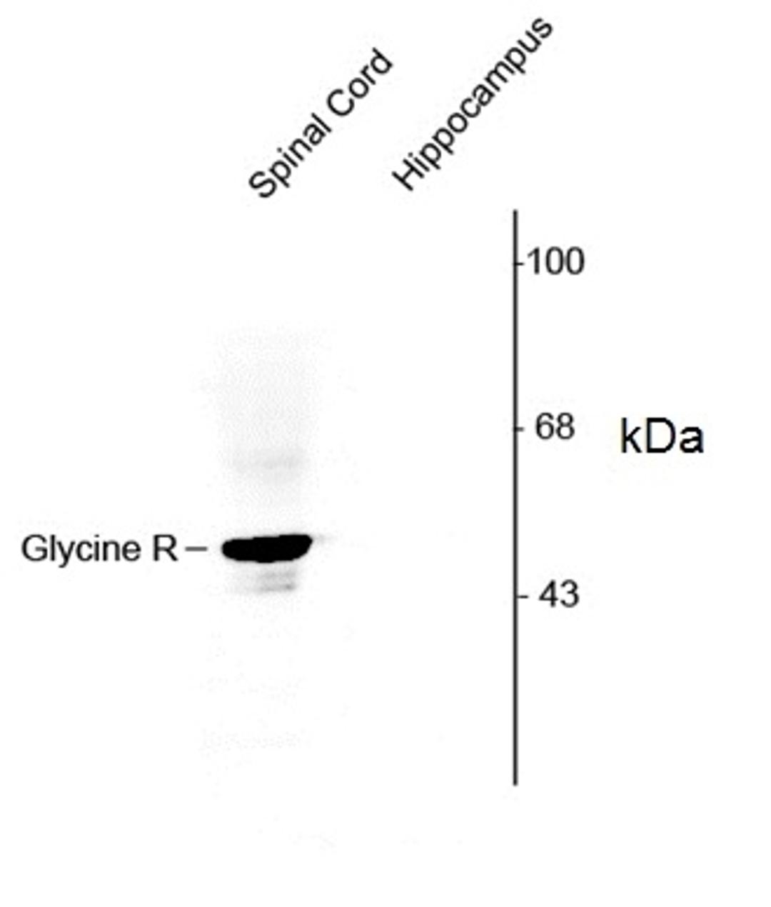 Western blot of rat spinal cord snd hippocamapl lysates s