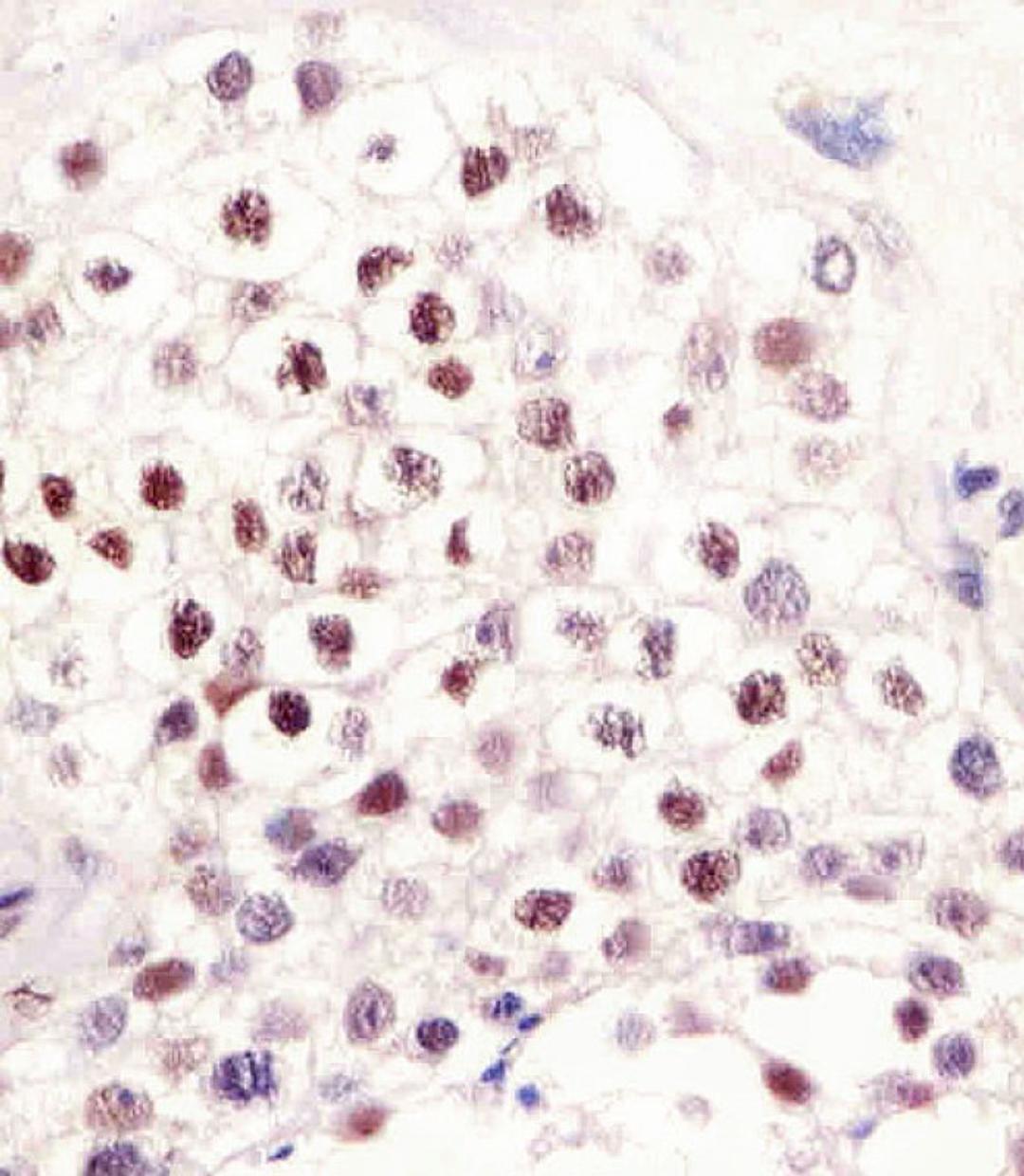 Antibody staining LIN28B in human testis tissue sections by Immunohistochemistry (IHC-P - paraformaldehyde-fixed, paraffin-embedded sections).