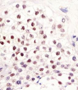 Antibody staining LIN28B in human testis tissue sections by Immunohistochemistry (IHC-P - paraformaldehyde-fixed, paraffin-embedded sections).