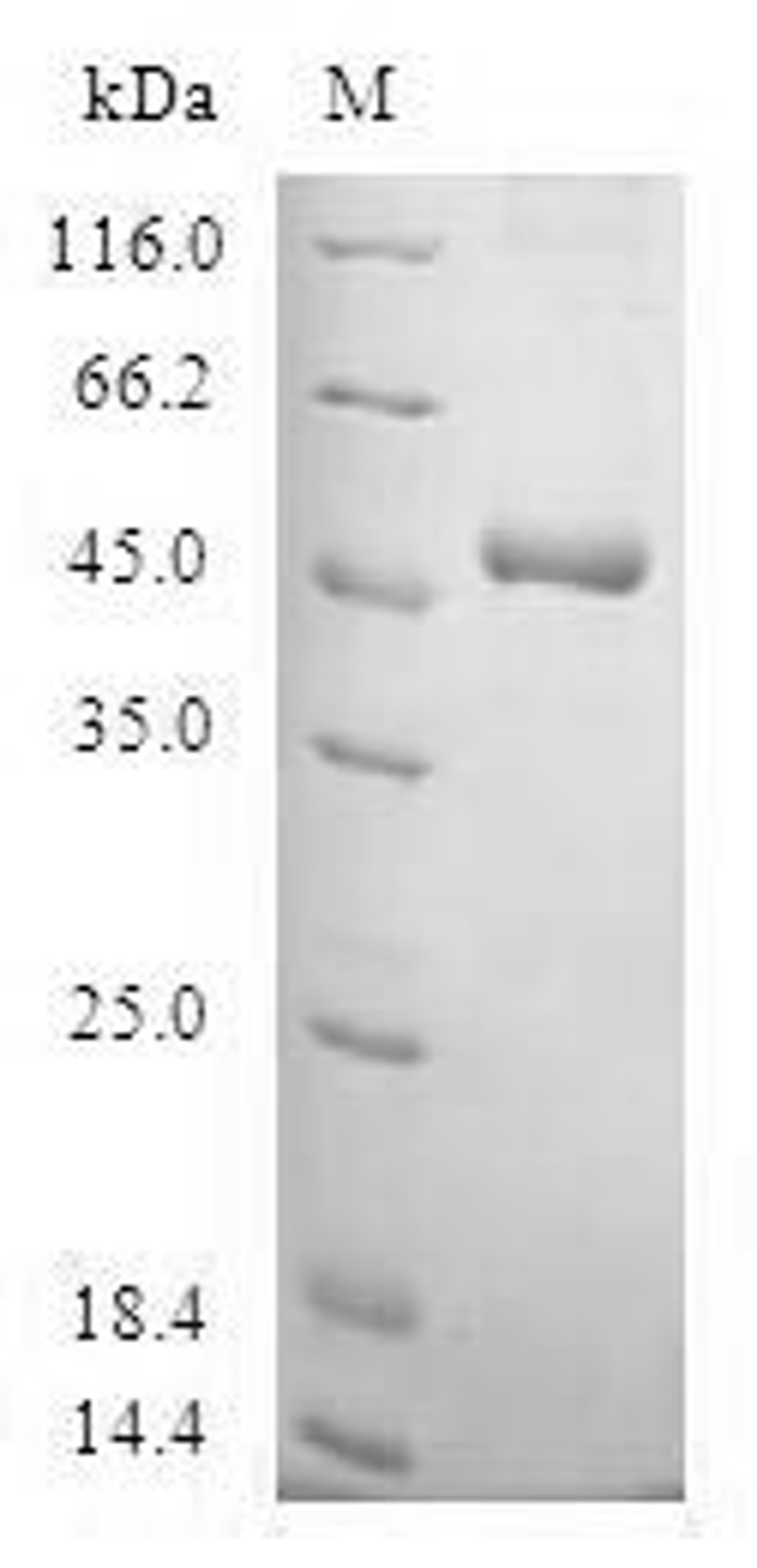 (Tris-Glycine gel) Discontinuous SDS-PAGE (reduced) with 5% enrichment gel and 15% separation gel.