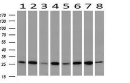 Western Blot: GBAS Antibody (1B8) [NBP2-45730] - Analysis of extracts (10ug) from 8 Human tissue (1: Testis; 2: Uterus; 3: Breast; 4: Brain; 5: Liver; 6: Ovary; 7: Thyroid gland; 8: Colon).