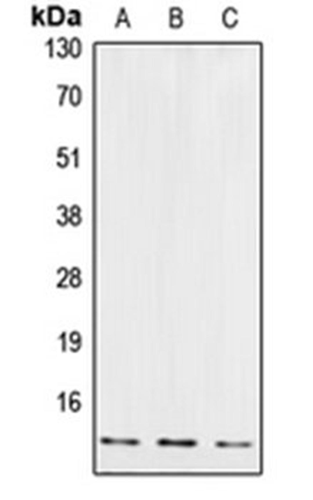 Western blot analysis of JAR (Lane 1), EOC20 (Lane 2), U87MG (Lane 3) whole cell lysates using CSTB antibody