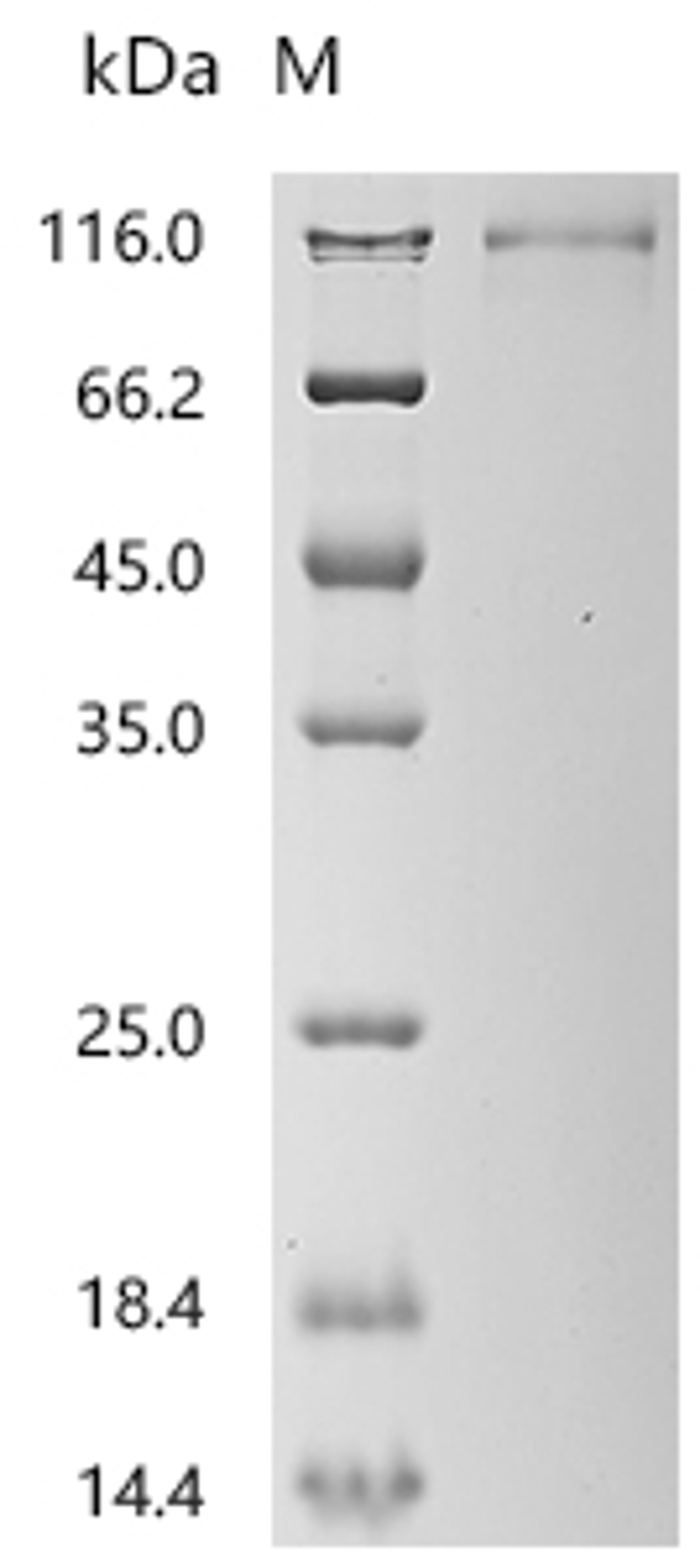 (Tris-Glycine gel) Discontinuous SDS-PAGE (reduced) with 5% enrichment gel and 15% separation gel.