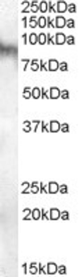 45-958 (0.1ug/ml) staining of Human Brain (Amygdala) lysate (35ug protein in RIPA buffer). Primary incubation was 1 hour. Detected by chemiluminescence.