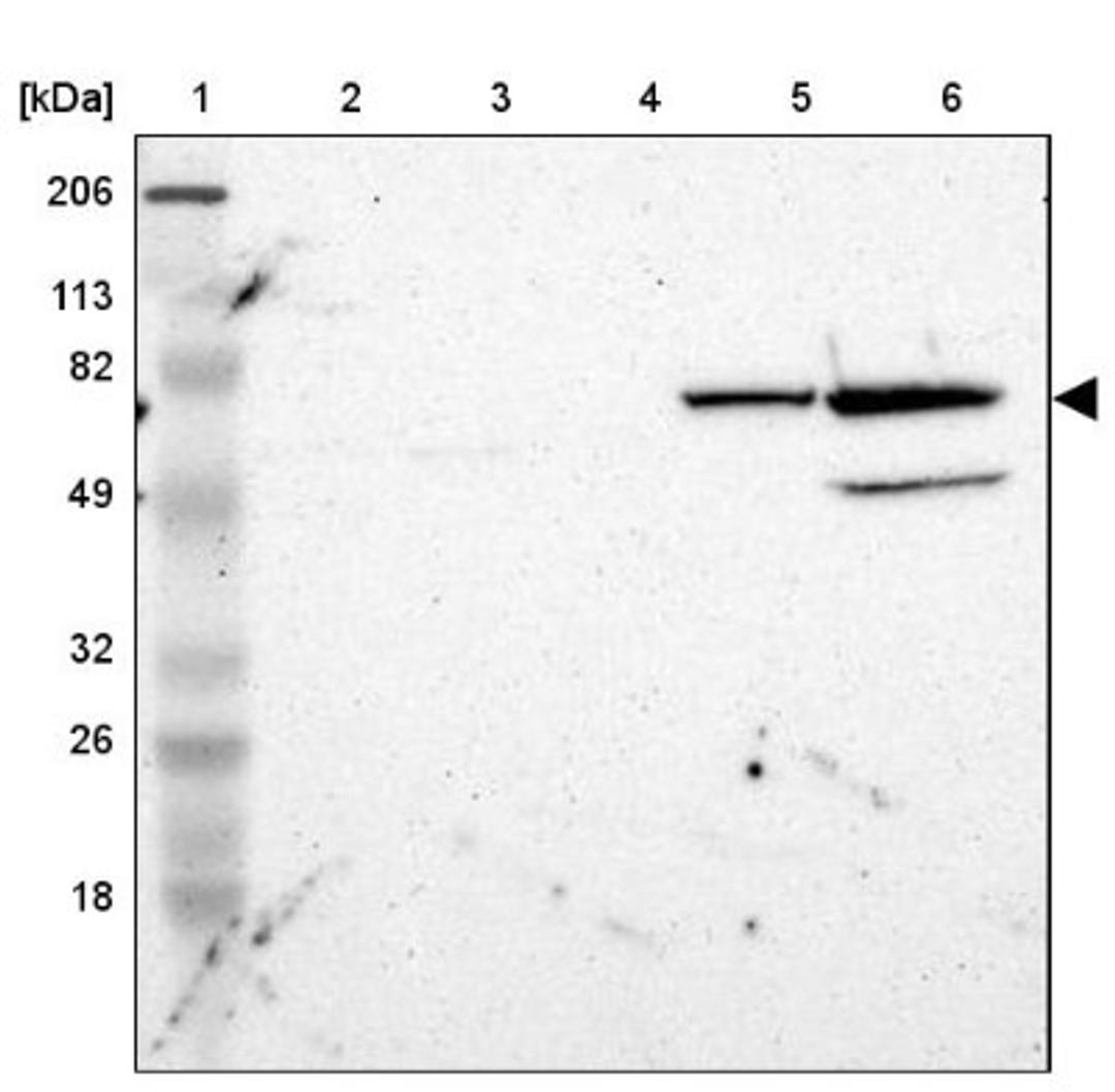 Western Blot: ZNF226 Antibody [NBP1-81631] - Lane 1: Marker [kDa] 206, 113, 82, 49, 32, 26, 18<br/>Lane 2: Human cell line RT-4<br/>Lane 3: Human cell line U-251MG sp<br/>Lane 4: Human cell line A-431<br/>Lane 5: Human liver tissue<br/>Lane 6: Human tonsil tissue