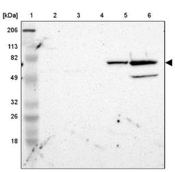 Western Blot: ZNF226 Antibody [NBP1-81631] - Lane 1: Marker [kDa] 206, 113, 82, 49, 32, 26, 18<br/>Lane 2: Human cell line RT-4<br/>Lane 3: Human cell line U-251MG sp<br/>Lane 4: Human cell line A-431<br/>Lane 5: Human liver tissue<br/>Lane 6: Human tonsil tissue