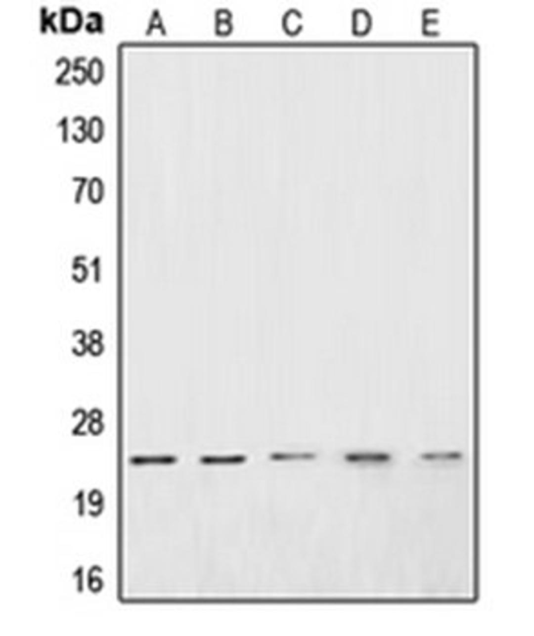 Western blot analysis of Jurkat (Lane 1), HeLa (Lane 2), PC3 (Lane 3), DU145 (Lane 4), A10 (Lane 5) whole cell lysates using CSRP1 antibody