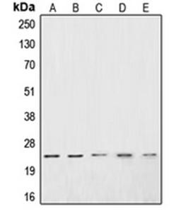 Western blot analysis of Jurkat (Lane 1), HeLa (Lane 2), PC3 (Lane 3), DU145 (Lane 4), A10 (Lane 5) whole cell lysates using CSRP1 antibody