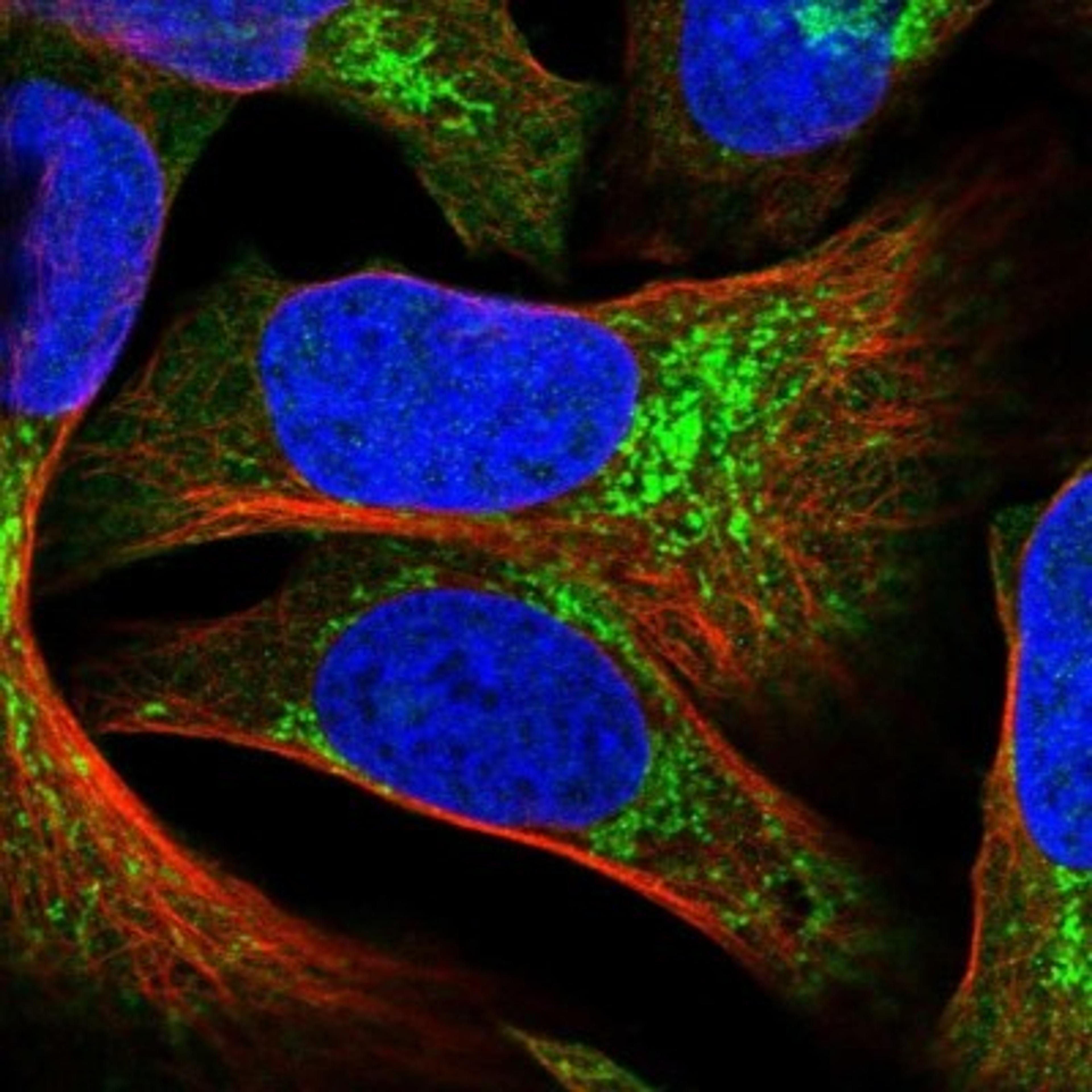 Immunocytochemistry/Immunofluorescence: TBC1D16 Antibody [NBP1-83635] - Staining of human cell line U-2 OS shows positivity in cytoplasm & mitochondria.