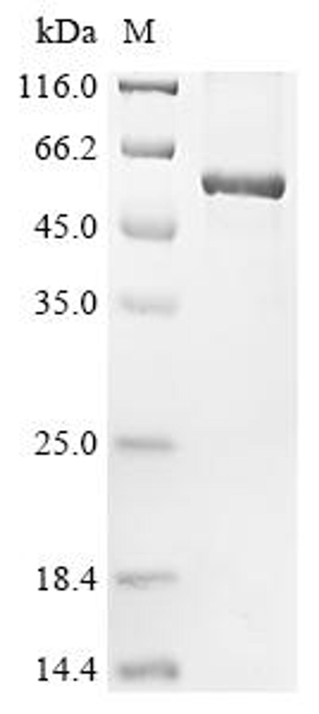(Tris-Glycine gel) Discontinuous SDS-PAGE (reduced) with 5% enrichment gel and 15% separation gel.