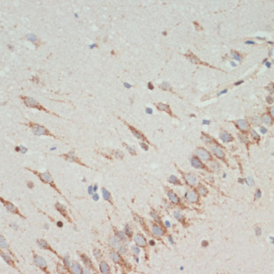 Immunohistochemistry  - TH antibody (A12756)