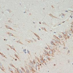 Immunohistochemistry  - TH antibody (A12756)