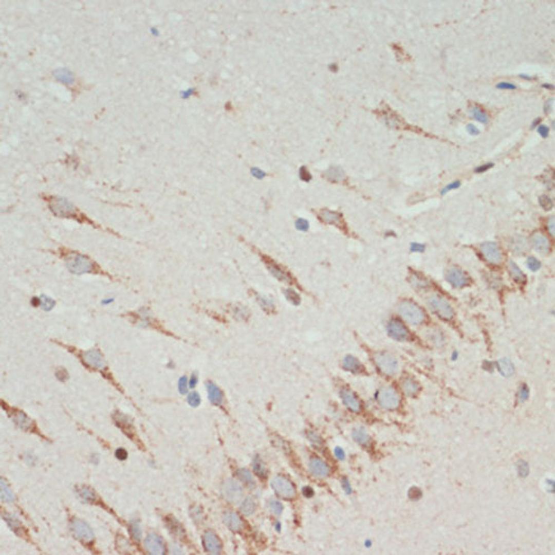 Immunohistochemistry - TH antibody (A12756)