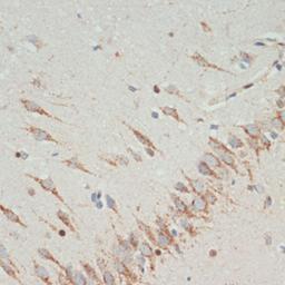 Immunohistochemistry - TH antibody (A12756)