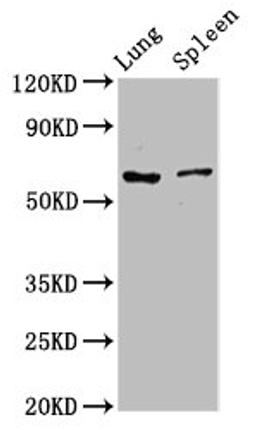 Western Blot. Positive WB detected in: Rat lung tissue, Rat spleen tissue. All lanes: RIPK2 antibody at 2.7µg/ml. Secondary. Goat polyclonal to rabbit IgG at 1/50000 dilution. Predicted band size: 62, 46 kDa. Observed band size: 62 kDa