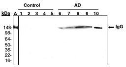 Western Blot: Methionine Sulfoxide Antibody [NBP1-06707] - Serums of Alzheimer's disease human subjects (1?5, samples from control human subjects; 6-10, samples of AD patients; all samples are aged matched (70-80 years old). A. A representative sample of human serum probed with primary rabbit anti-human IgG antibodies. Data courtesy of Dr. Moskovitz (1).