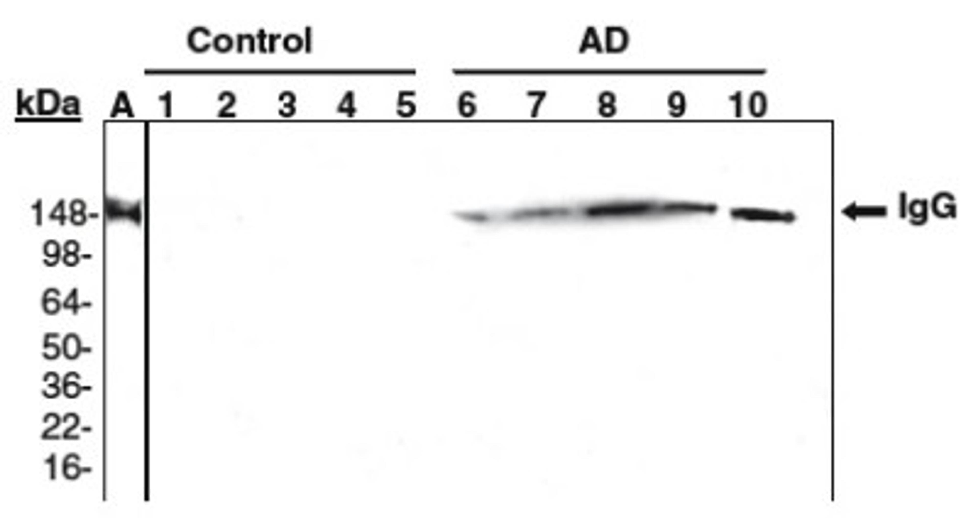 Western Blot: Methionine Sulfoxide Antibody [NBP1-06707] - Serums of Alzheimer's disease human subjects (1?5, samples from control human subjects; 6-10, samples of AD patients; all samples are aged matched (70-80 years old). A. A representative sample of human serum probed with primary rabbit anti-human IgG antibodies. Data courtesy of Dr. Moskovitz (1).