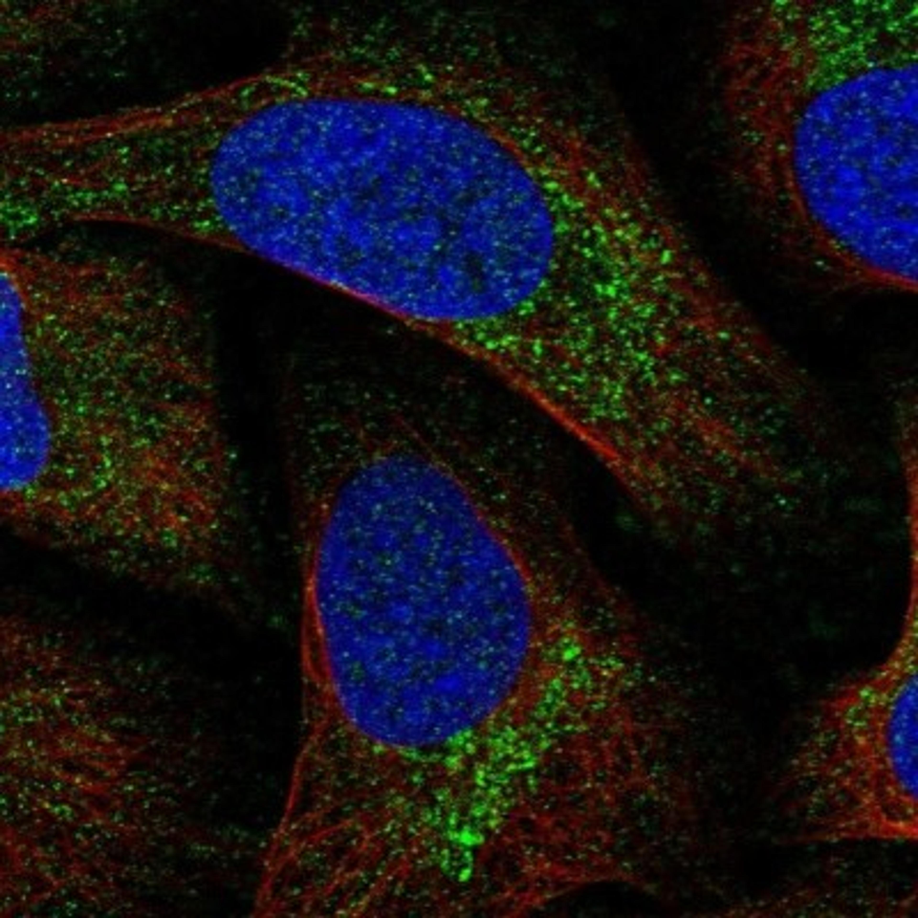 Immunofluorescence: MITD1 Antibody [NBP1-82828] - Staining of human cell line U-2 OS shows positivity in vesicles.