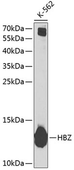 Western blot - HBZ Antibody (A6920)