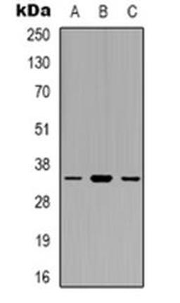 Western blot analysis of EIF3J expression in SHSY5Y (Lane 1), HEK293T (Lane 2), NIH3T3 (Lane 3) whole cell lysates using EIF3J antibody