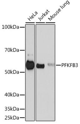 Western blot - PFKFB3 Rabbit mAb (A3934)