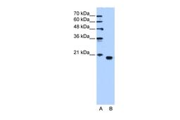 Antibody used in WB on Human HepG2 cells at 1.25 ug/ml.