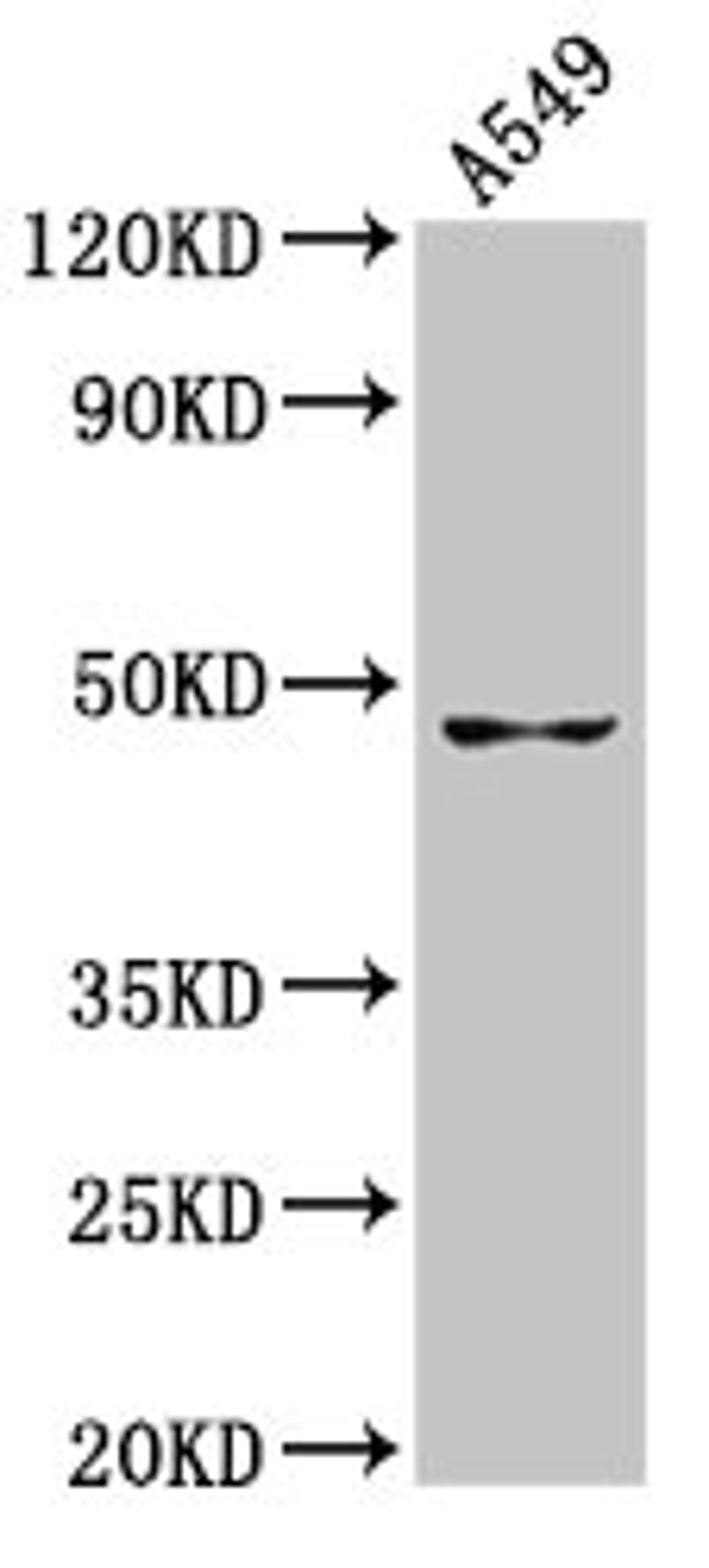 Western Blot. Positive WB detected in: A549 whole cell lysate. All lanes: GDF7 antibody at 7.9µg/ml. Secondary. Goat polyclonal to rabbit IgG at 1/50000 dilution. Predicted band size: 47 kDa. Observed band size: 47 kDa