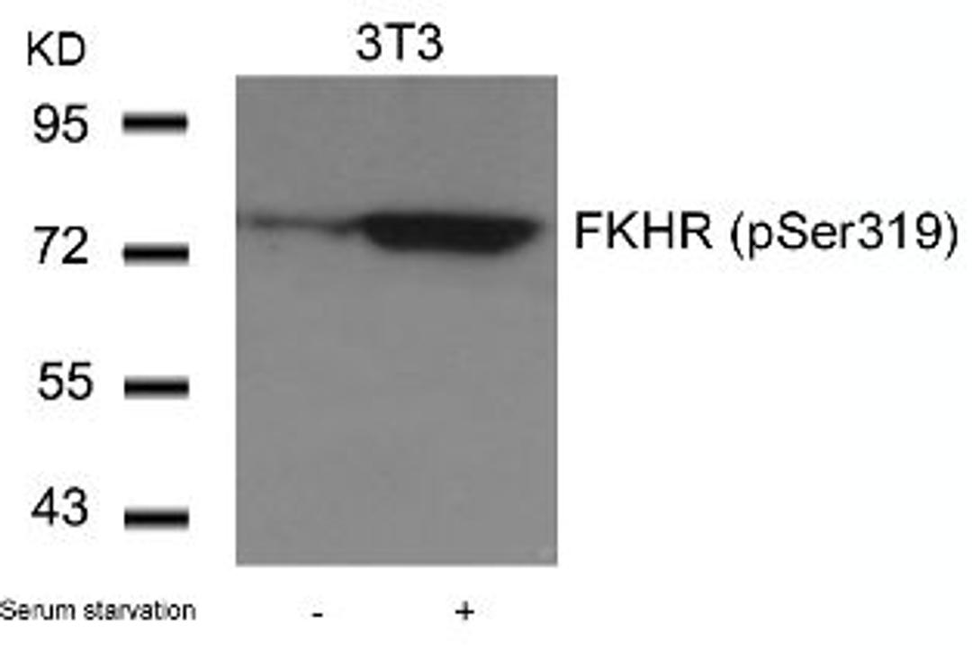 Western blot analysis of lysed extracts from 3T3 cells untreated or treated with serum starvation using FKHR (Phospho-Ser319).