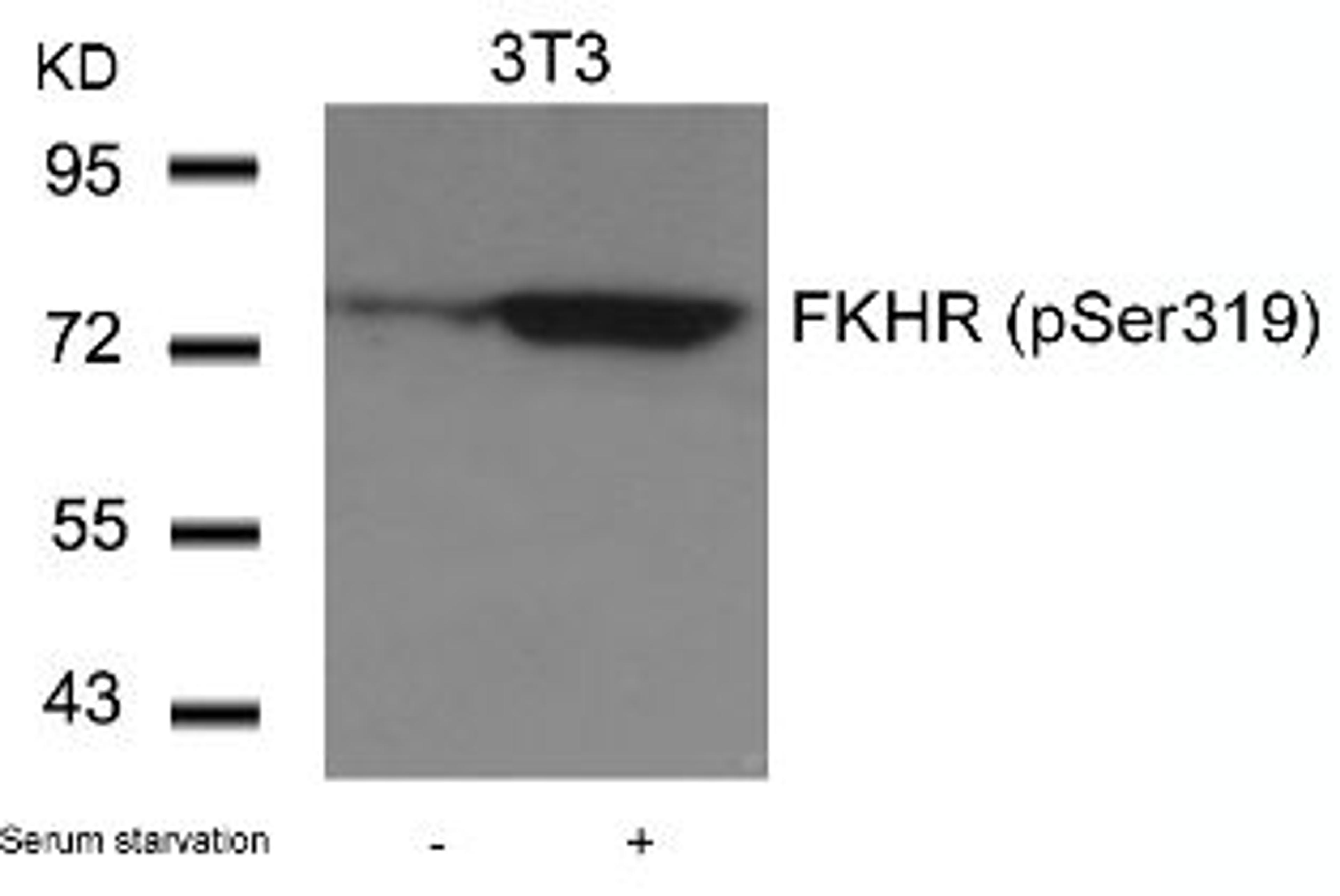 Western blot analysis of lysed extracts from 3T3 cells untreated or treated with serum starvation using FKHR (Phospho-Ser319).