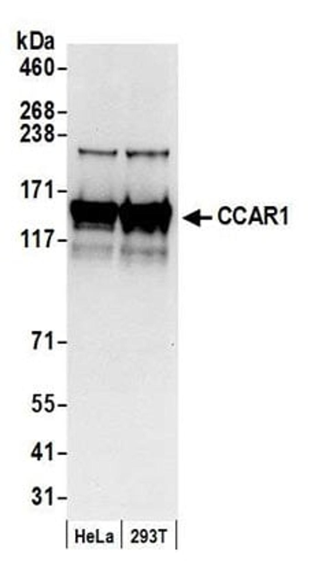 Detection of human CCAR1 by western blot.